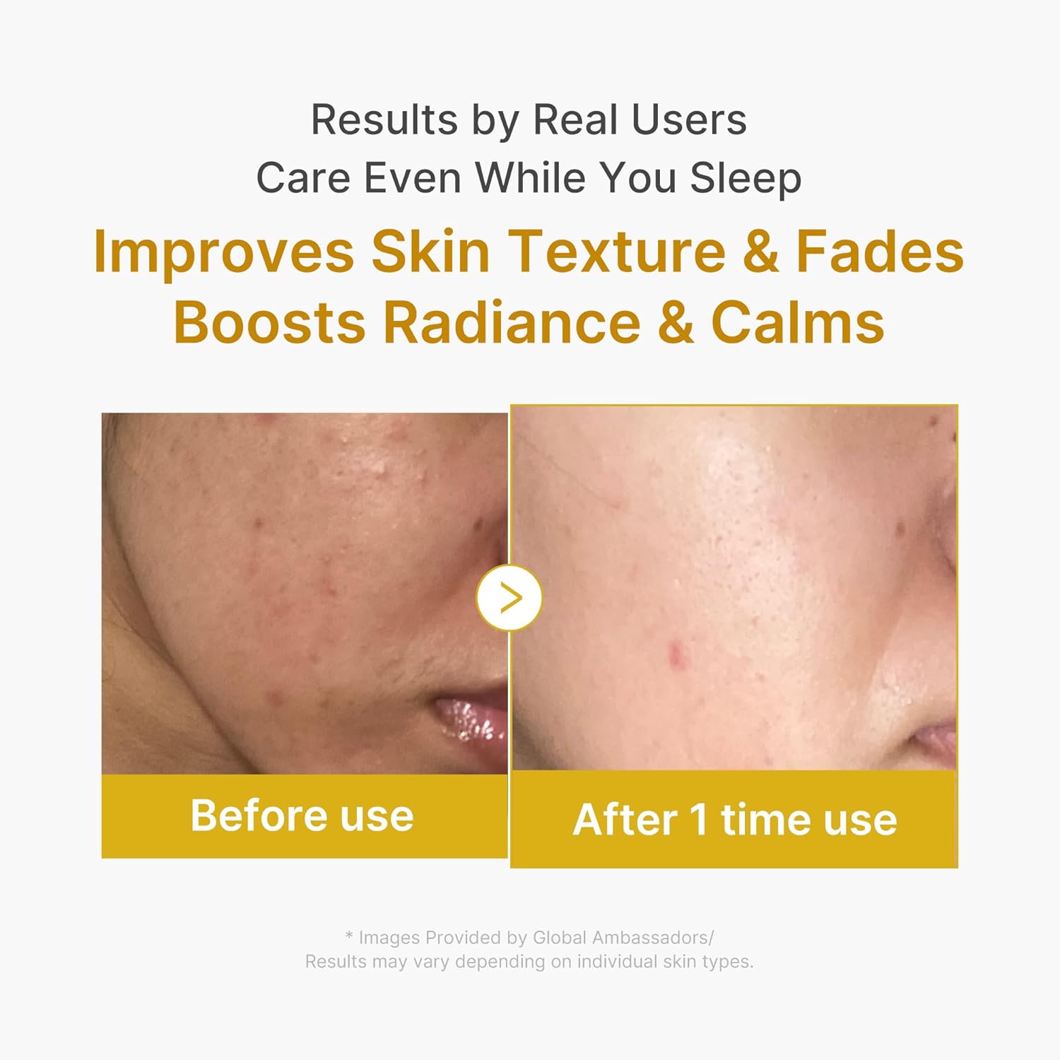 medicube Kojic Acid Turmeric Night Wrapping Mask 75ml | Korean Skincare