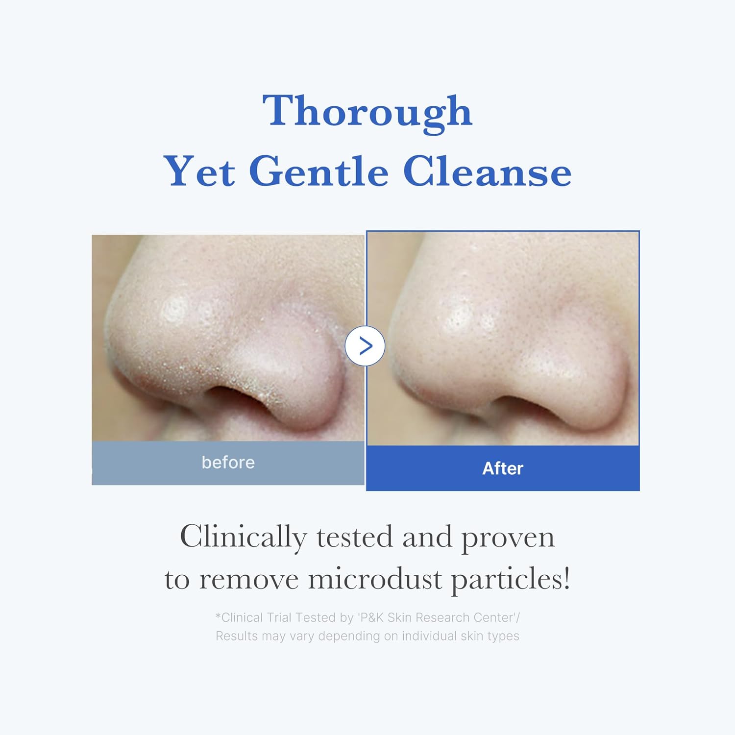 medicube Zero Foam Cleanser 120g | Pore & Excess Oil Care | Korean Skincare