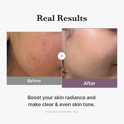 medicube Age-R Glutathione Glow Milky Toner 140ml | Korean Skin Care