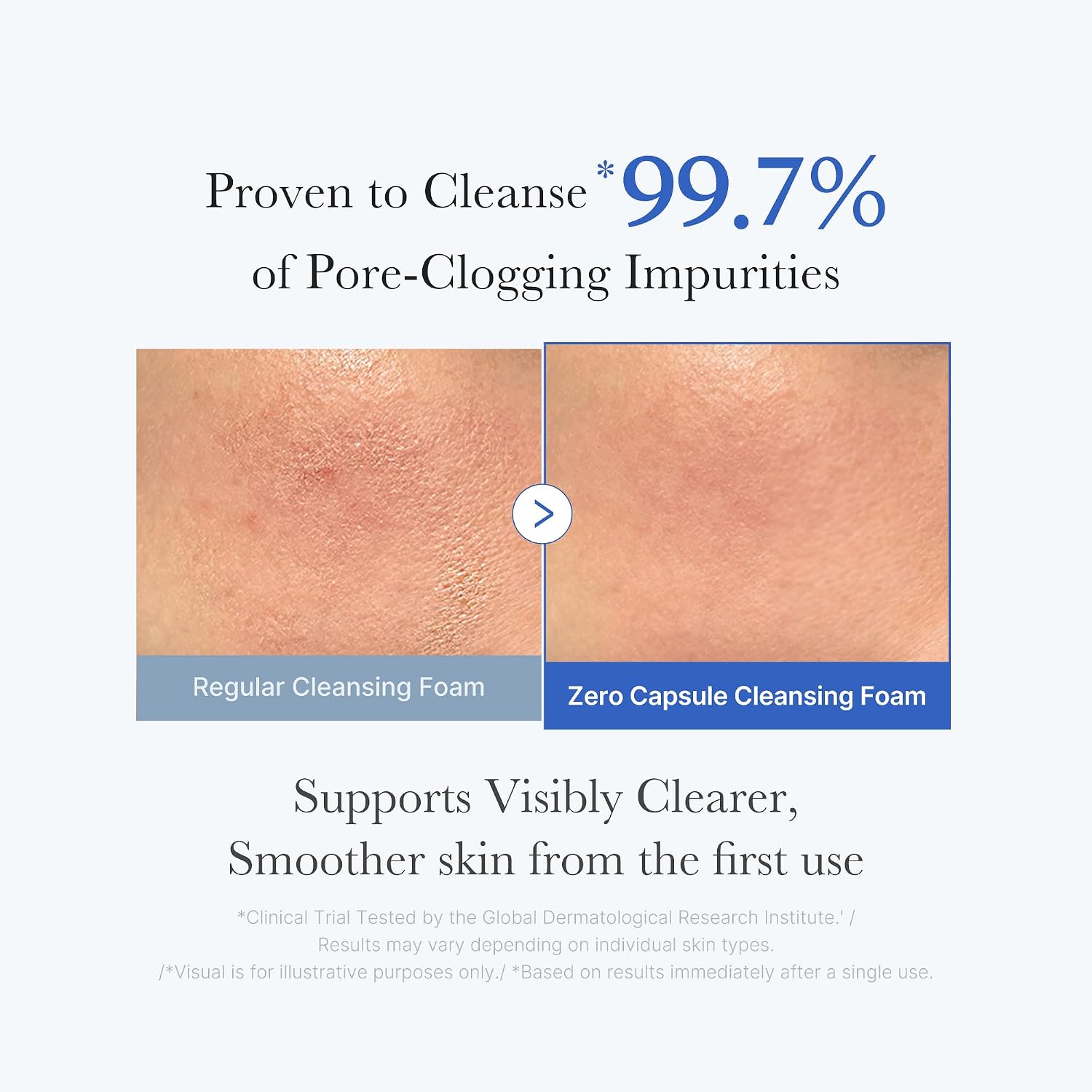 medicube Zero Pore Capsule Cleansing Foam 120g | Korean Skincare