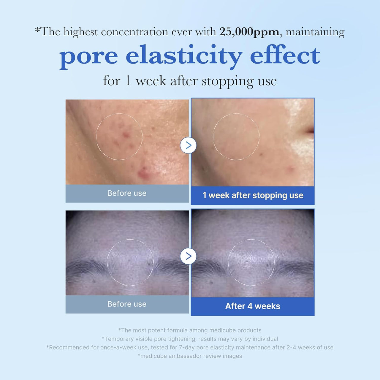 medicube Exosome Shot Zero 25,000 PPM Spicule Facial Serum 13ml | Korean Skincare