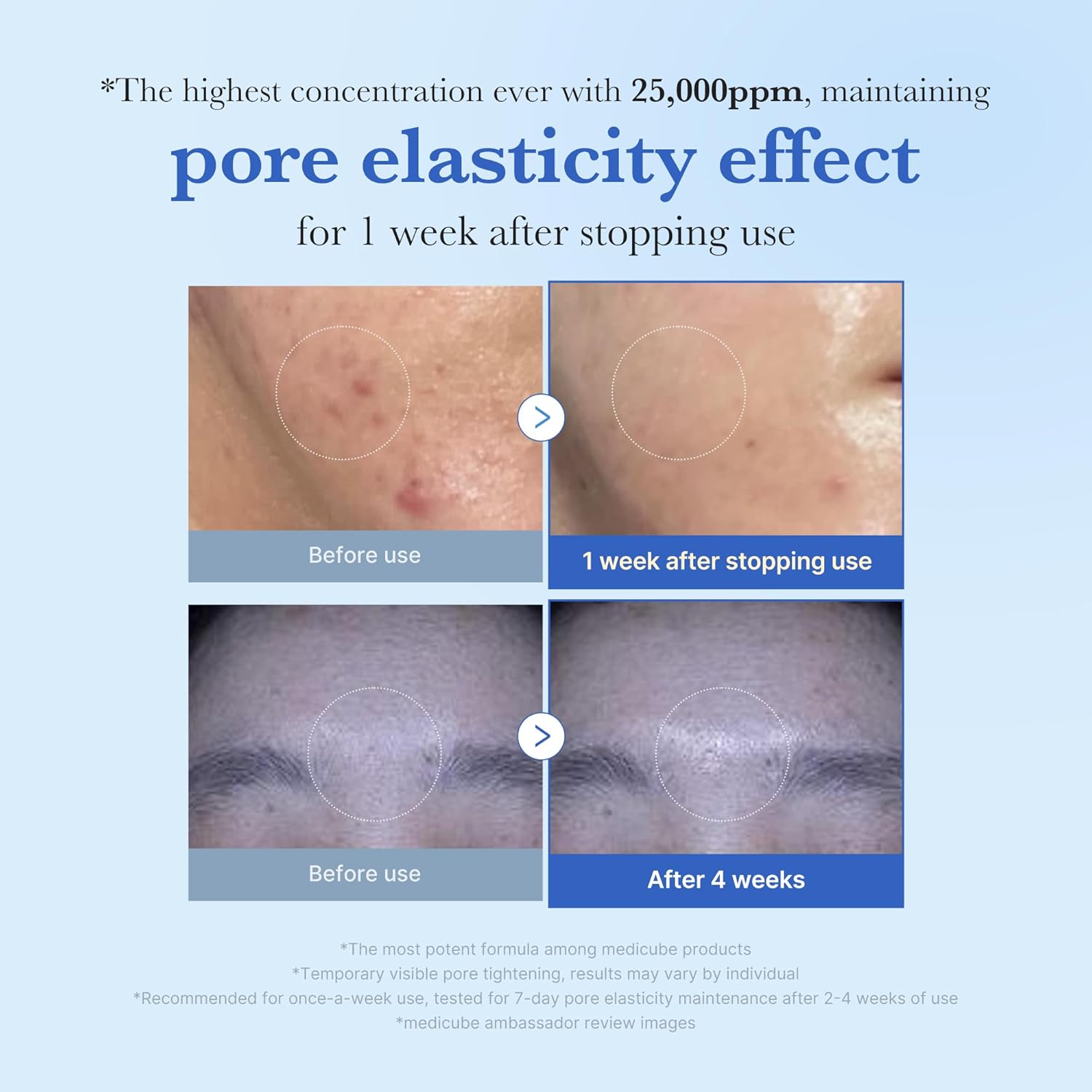 medicube Exosome Shot Zero 25,000 PPM Spicule Facial Serum 13ml | Korean Skincare