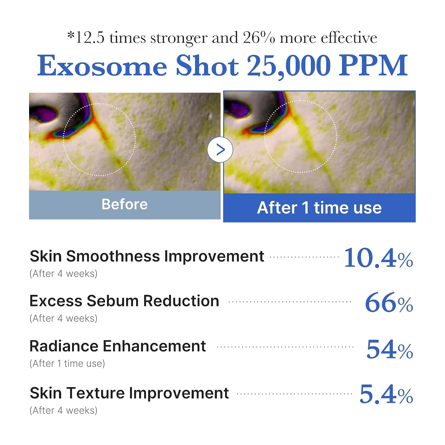medicube Exosome Shot Zero 25,000 PPM Spicule Facial Serum 13ml | Korean Skincare