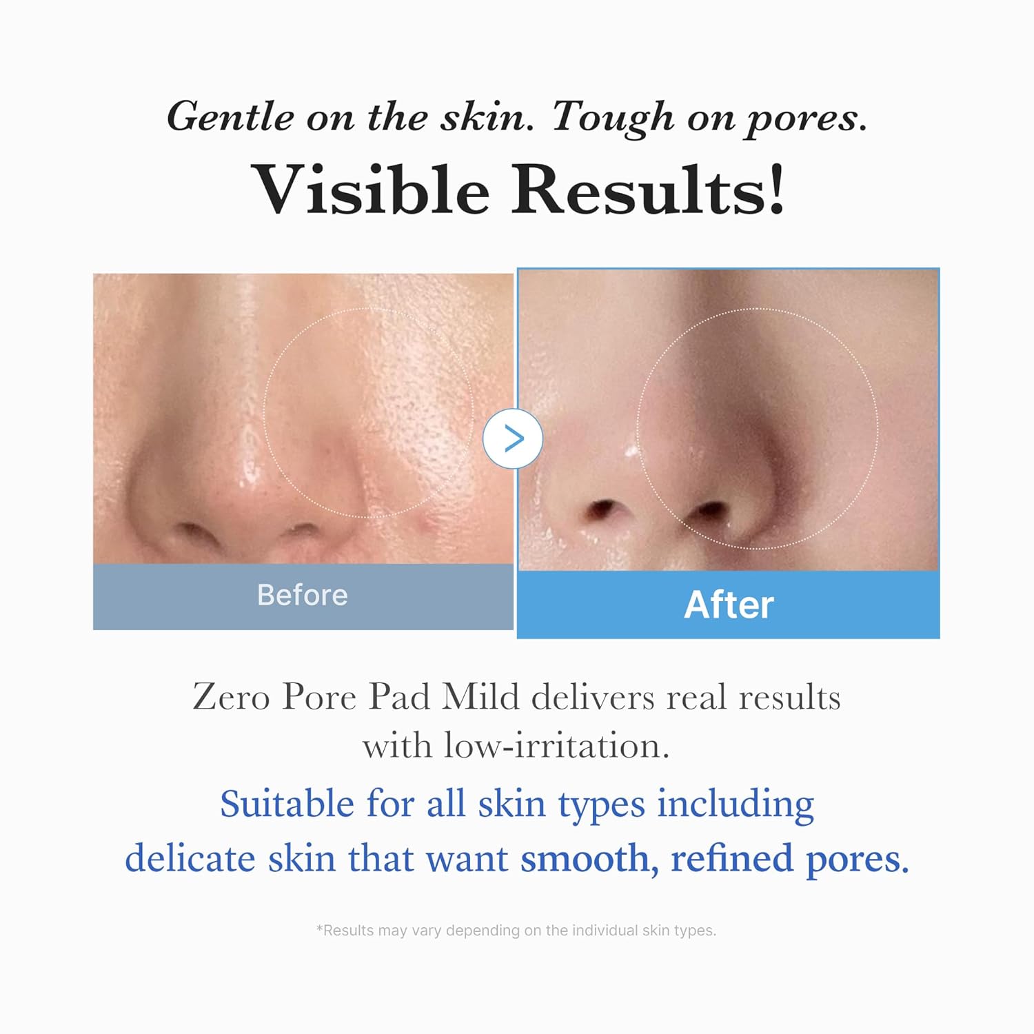 medicube Zero Pore Pad Mild 2.0 | Gentle Exfoliating Korean Skincare