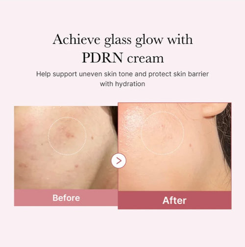 medicube PDRN Pink hyaluronic Moisturizing Cream 50ml, Korean Skin Care