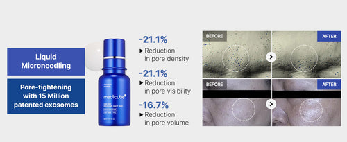 medicube ZERO One Day Exosome Shot Pore Serum 30ml/13ml, Korean Skin Care